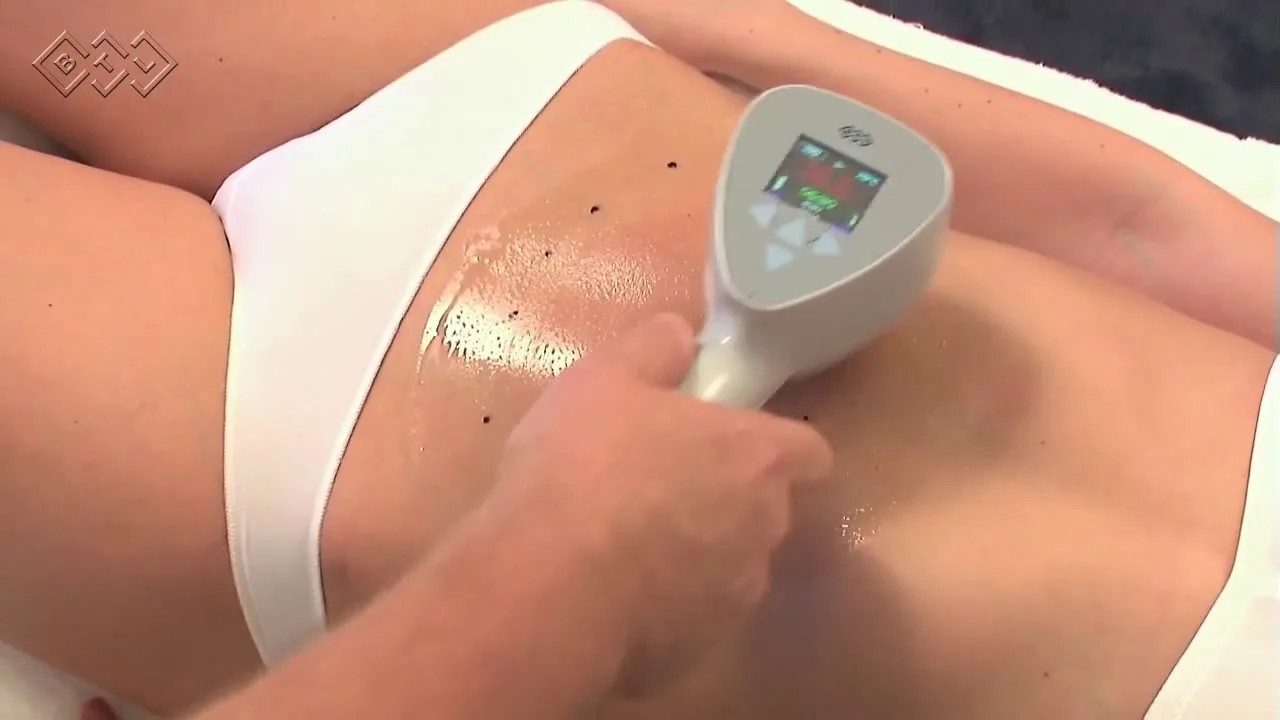 Exilis Ultra 360 à Bruxelles