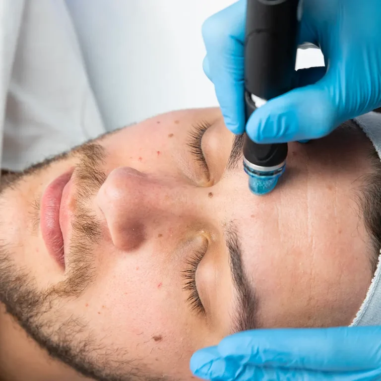 Hydrafacial (1)