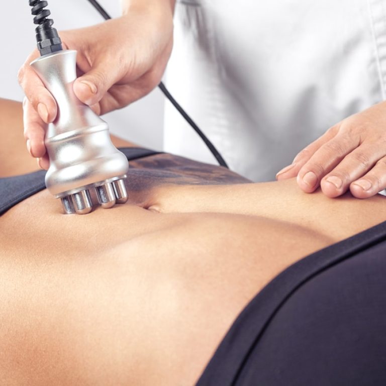 lipocavitation-ile-de-beaute