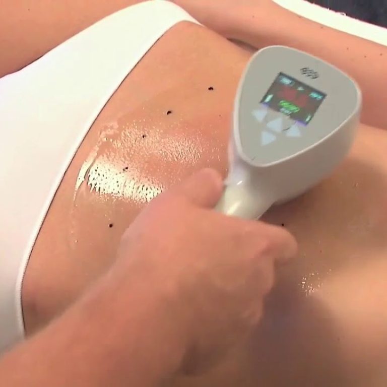 thumb-exilis